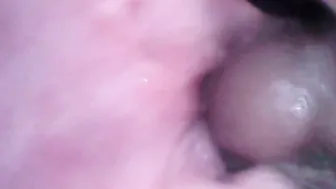 Endoscopy plowed the twat