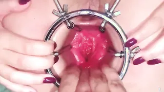 Fisting Latinas Speculum Gaped Butt