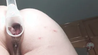 Anal speculum standing