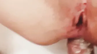 Papi me duele mi oyito