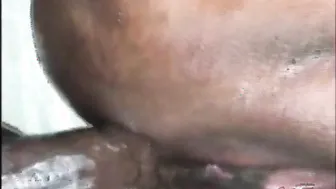 Close Up Screwed Bald Twat And Anal Rough Monster Penis