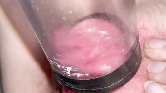 Clitoris blown by vacuum cleaner inside clear tube