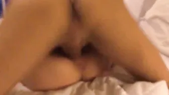 My Dancer Sister Getting Her Back Sucked Out