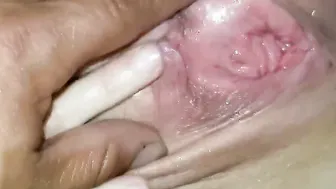 Squirt fountain