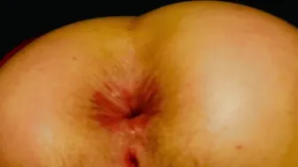 Nurse Scarlets doggie style anal cumshot