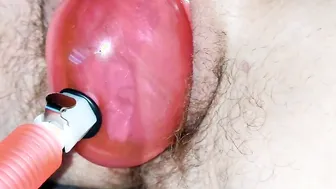 Pumping and Stretching Tight Unshaved Vagina Preview