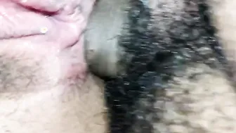 Anal close-up