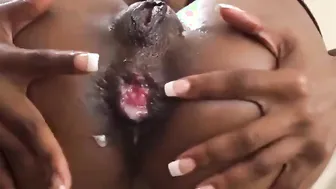 Anal african