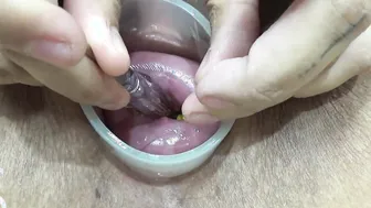 Penetrating my cervix with several screwdrivers - Maya Simons