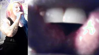 Vore Endoscopy