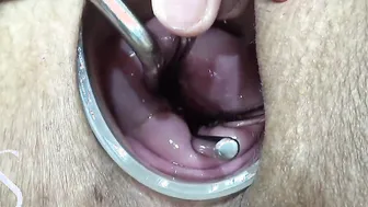 Maya Simons OPENING HER CERVIX (INSANE)