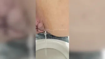 Anal gas from gigantic anus