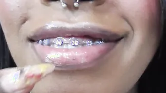 Tattoo Piercing Bondage Teeth Braces bondage