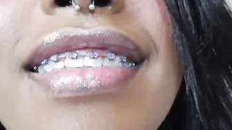 Tattoo Piercing Bondage Teeth Braces bondage