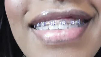Tattoo Piercing Bondage Teeth Braces bondage