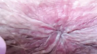 Asshole exteme closeup booty bdsm anal