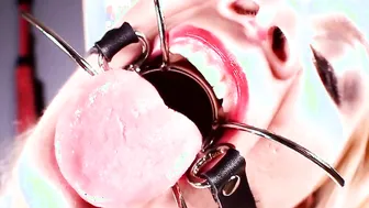 Mouth Inspection: Gagged