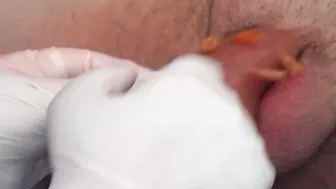 German Grandma Fist Guy anal and needle his penis painful