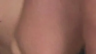 HCVDVX1514
