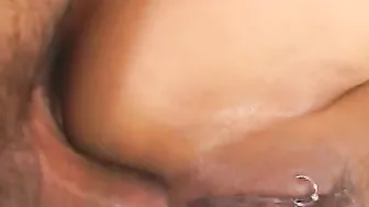 HCVAR0079