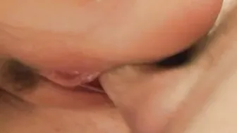HCVMA0003