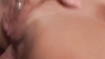 HCVAR0028