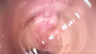 Internal porn video – Camera deep into Stepsisters barely legal creamy vagina