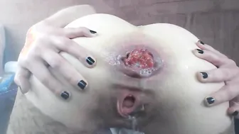 Bombshell Blonde Is Anal Addicted Prolapse Skank