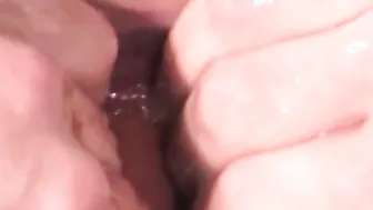 Wide gaping asshole after an insane gay fisting session