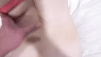 Bald Pussy Problems
