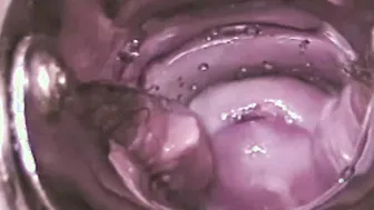 these are the genitalia of an ordinary amateur couple