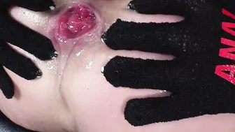 Lanas Anal Return