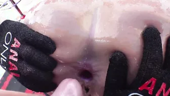 Sophias Anal Practice